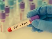 Universidad de Panamá y Ministerio de Salud realizarán jornada de pruebas rápidas de VIH para Estudiantes y Personal Universitario
