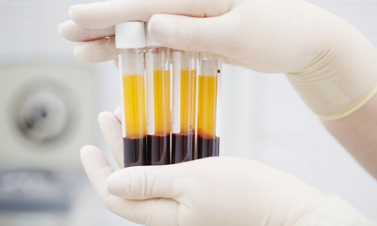 Comisión de la USAC desarrolla prueba sanguínea de detección rápida para coronavirus