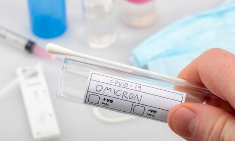 75 muestras fueron enviadas a Panamá para descartar o confirmar variante ómicron